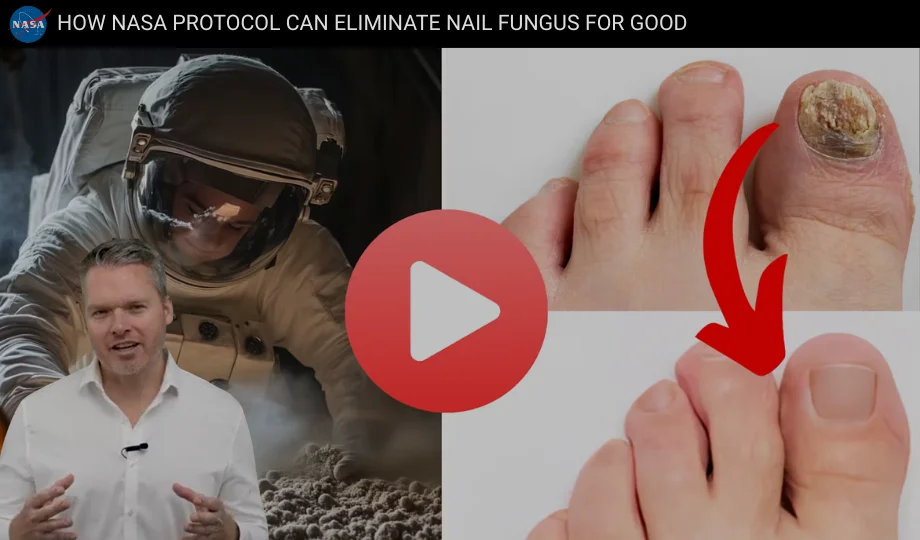 Before and after toenail treatment comparison